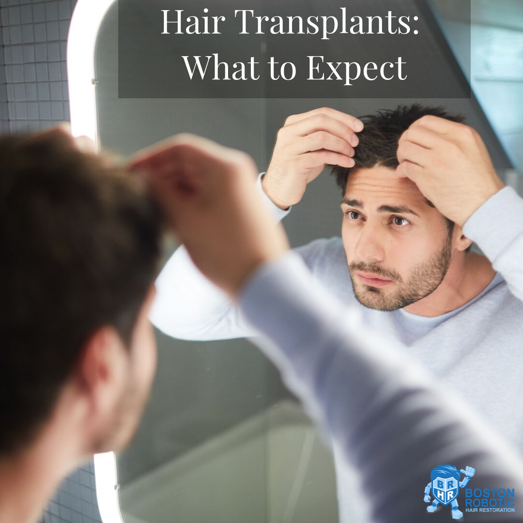 Are you a good candidate for hair transplant surgery? - Dr Bonaros